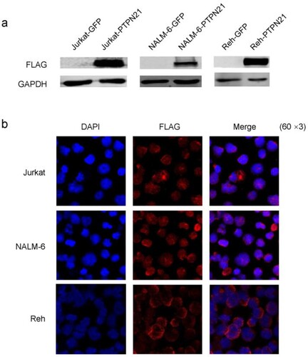 Figure 1. PTPN21 was successfully overexpressed in Jurkat, NALM-6, and Reh cells. (a) Western blot data show that Flag-PTPN21 was overexpressed in Jurkat, NALM-6, and Reh cells. GAPDH was used as the internal control. (b) IF results reveal that Flag-PTPN21 could be detected in the transfected Jurkat, NALM-6, and Reh cells.