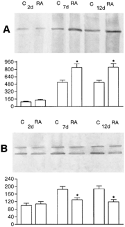 2 Western blot analysis of E-cadherin (A) and phosphotyrosine (B) after immunoprecipitation with anti β-catenin in HepG2 cells cultured for 2, 7, and 12 days in the absence (C) or presence of retinoic acid (RA). Densitometric evaluation of the bands, expressed as percentage of control after two days of culture, shows an increase of about 40% after 7 and 12 days of treatment in the amount of E-cadherin bound to β-catenin (A) and a decrease of about 35%, after 7 and 45% after 12 days of RA treatment in the amount of tyrosine-phosphorylated β-catenin (B). Results are the average of at least four different experiments ±S.D. *P < 0.05.