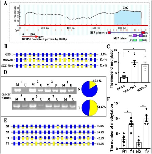 Figure 4 Promoter methylation affects the expression of BRMS1. (A) Bioinformatic prediction of one CpG island upstream of BRMS1, which is mainly concentrated 300 bp above the transcription start site. (B) The bisulfite sequencing of the BRMS1 upstream region in MKN-28, SGC-7901 and GES-1 cell lines analyzed by BiQ Analyzer. (C) The number of methylations was higher in MKN-28 and SGC-7901 than in GES-1. (D) Representative MSP analyses for BRMS1 methylation in GC tissues. U, unmethylated state; M, methylated state. (E) The bisulfite sequencing of the BRMS1 upstream region in 2 paired GC tissues and paracarcinoma tissues analyzed by BiQ Analyzer. Each square represents a CpG site. For the figure B and E, methylated CpG dinucleotides are represented by yellow squares whereas unmethylated CpG sites are represented by blue squares. If the methylation state of a CpG site could not be defined, it is represented as not present. (F) The number of methylations was higher in GC tissues than in para-carcinoma tissues. *P<0.05.