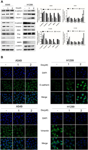 Figure 4 Effect of dioscin on the expression of EMT markers in H1299 and A549 cells. (A) Cells were treated with dioscin (1 and 2 µM) for 24 h, and the EMT-associated biomarkers were detected using Western blotting. Typical graphs and a histogram (mean ± SD) are shown, n = 3. *p < 0.05; **p< 0.01; ***p< 0.001 compared with the control group. (B) After treatment with dioscin (1 and 2 µM) for 24 h, immunofluorescence staining was performed to determined Vimentin and E-cadherin expression in H1299 and A549 cells using confocal microscopy. Blue fluorescence indicates DAPI-labeled nuclei, and Green fluorescence indicates Vimentin or E-cadherin positive expression.