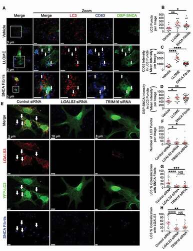 Figure 8. Lysosomal rupture increases the formation of amphisomes DSP-SNCA SH-SY5Y cells and the depletion of LGALS3 or TRIM16 reduces the recruitment of SNCA fibrils to autophagosomes in mDA neurons. (A) Representative images from DSP-SNCA SH-SY5Y cells treated vehicle or LLOME for 4 h or SNCA fibrils for 24 h and subsequently stained for LC3B and CD63. The same end point was used for all conditions. The white arrows point to instances of triple labeled events. (B) Quantification of the number of LC3B puncta recognized by a masking algorithm among images. (C, D) Quantification of DSP-SNCA (C) or CD63 (D) intensity in masked LC3B puncta. Each data points represents the averaged maximum intensity from the total masked puncta in an individual image. The same algorithm was applied to all experiments and treatment conditions. (E) Representative images of induced YFP-LC3 (green) transduced mDA neuronal cultures treated with SNCA fibrils (blue) and stained for endogenous LGALS3 (red) shown at the same intensities for each of the channels for each condition. YFP-LC3 induction was initiated 24 h post-transfection. SNCA fibrils treatment was done 48 h post-transfection. Staining was conducted 72 h post-transfection. The white arrows point to triple colocalization of YFP-LC3, LGALS3, and SNCA fibrils. (F) Quantification of the number of YFP-LC3 puncta recognized by a masking algorithm among images for the indicated siRNA pretreated condition. (G, H) Quantification of the degree of masked YFP-LC3 puncta colocalized with SNCA fibrils puncta (G) and LGALS3 puncta (H). Each data point is the mean of 3 randomly selected coverslips (n = 15–20 images per coverslip). (A-D) Intensity data are expressed as M ± SE (n = 3 independent experiments, 7–10 images per experiment). Statistical significance was determined by one-way ANOVA with Dunnett’s post hoc tests (A-D) or with Tukey’s post hoc tests (E-H). For all statistical tests *, **, ***, ****, p < 0.05, 0.01, 0.001, and 0.0001, respectively.