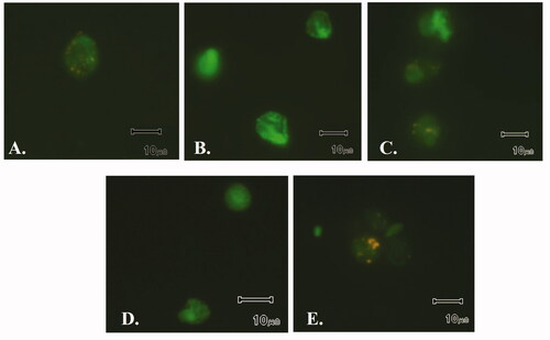 Figure 3. Fluorescence emitted by JC-1 in hydrogenosome. A. Control. B. Positive control (treatment with the uncoupler agent CCCP). C. Treatment with MTZ. D. Treatment with 51. E. Treatment with 63.