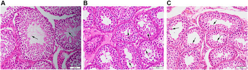 Figure 3 Histological changes in the testis of each group. Microphotographs taken of group C (A, arrowhead, spermatozoa), group IRI (B, arrowhead, spermatids), and group Dex (C, arrowhead, spermatids) testis subjected to HE staining; 400× magnification; scale bars, 50 μm.