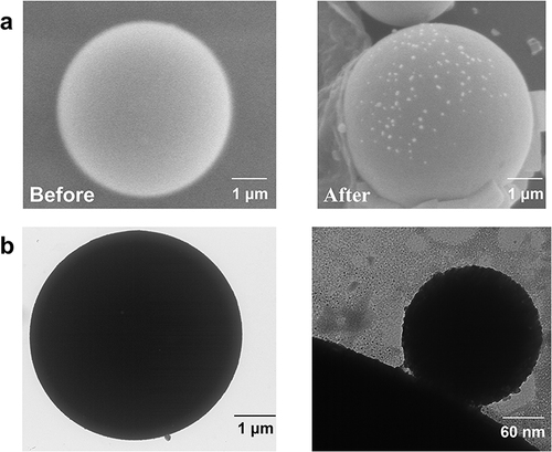 Figure 2 Characterization and validation of the TiO2-based liposome samples: (a) SEM and (b) TEM images.