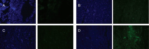 Figure 9. Detection of apoptotic cells by fluorescence microscopy of frozen tumour sections. Apoptosis was determined by TUNEL. The left panel shows the sections stained with DAPI and the right panel shows TUNEL. Negative control (A), free paclitaxel (B), paclitaxel-loaded micelles without TATp (C), paclitaxel-loaded micelles with TATp (D). Magnification ×20 objective. Modified from CitationSawant and Torchilin (Citation2009).