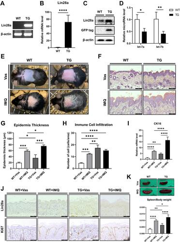 Figure 4 Promoted proliferation of keratinocytes in established Lin28a TG mice: (A) PCR was performed to identify Lin28a overexpressing mice. Primers pAcGFP.N1.F and Lin28a.R were used to detect the exogenous gene for PCR genotyping; (B) total RNAs were isolated from mouse skin tissue and reverse transcribed. Lin28a mRNA expression levels in the skin were analyzed via RT-PCR. Tissue samples were collected from 8–12-week-old mice (n = 6–7); (C) overexpressed protein levels were confirmed through Western blotting in mouse skin tissue; (D) total RNAs were isolated from mouse skin tissue and reverse transcribed using TaqMan MicroRNA Reverse Transcription Kit. Relative expression levels of let-7 microRNAs were measured by real-time PCR using TaqMan™ MicroRNA Assay. T-tests were performed using GraphPad Prism 9. All data are presented as mean ± SEM; *p < 0.05, **p < 0.01, ***p < 0.001, and ****p < 0.0001 compared with WT mice. WT and Lin28a TG mice were treated with a daily topical dose of 62.5 mg of IMQ cream (5%) for 5 consecutive days and control mice were treated with the same dose of Vas for 5 consecutive days: (E) phenotypic presentation of mouse back skin for WT and Lin28a TG mice treated with IMQ or Vas for 5 days; (F) light microscopy examination of skin sections stained with H&E. Scale bars represent 128 μm; (G) skin thickness was measured in the epidermis of WT and Lin28a TG mice treated with IMQ or Vas for 5 days; (H) immune cell infiltration was measured by counting the cells stained in the dermis from the results of H&E staining; (I) total RNAs were isolated from mouse skin tissue and reverse transcribed. Relative mRNA expression levels of CK16, proliferation marker, were analyzed by RT-PCR; (J) light microscopy examination of skin sections stained with Lin28a or Ki67 antibody, scale bars = 128 μm; (K) phenotypic presentation of mouse spleen and spleen/body weight for WT and Lin28a TG mice treated with IMQ or Vas for 5 days. Two-way ANOVA followed by Tukey’s multiple comparisons test was performed using GraphPad Prism 9. All data are presented as mean ± SEM; *p < 0.05, **p < 0.01, ***p < 0.001, and ****p < 0.0001 compared with each group.