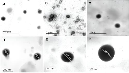 Figure 2 Transmission electron micrographs of GPS-PLGA NSs. F2: A&D, F5: B&E, and F8:C&F (Formulae code shown in Table 1). Captured at low magnification; (A–C) and at high magnification: (D–F). Image J software utilized for measurements display.