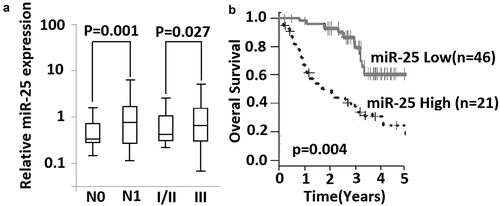 Figure 1. Expression of miR-25 is associated with lymph node metastasis and survival of NSCLC patients. (a) relative expression of miR-25 was compared between lymph node metastasis (N1) and without lymph node metastasis (N0), and between patients in stage I-II and patients in stage III. Mann–Whitney U test was used. Box and whisker show median value with 10–90% percentile. (b) 67 NSCLC patients with their following information available were classified into high expression group (n= 21) and low expression group (n= 46) by the 75th percentiles of 2ΔΔCt. Shown is Kaplan-Meier overall survival curves of two group patients, Log-rank test was used.