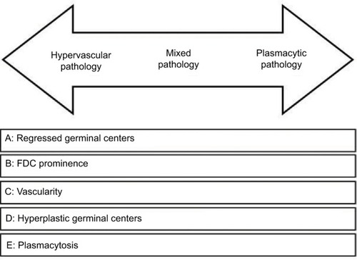 Figure 3 Histopathologic features of Castleman’s disease. Hypervascular subtype is characterized by the presence of regressed germinal centers and prominent FDC, whereas the plasmacytic subtype exhibits hyperplastic germinal centers and profuse plasmacytosis. The mixed subtype exhibits a combination of hypervascular and plasmocytic features. Vascularity is frequently observed in idiopathic multicentric Castleman’s disease but can be seen in either subtype as well. Republished with permission of American Society of Hematology, from International, evidencebased consensus diagnostic criteria for HHV-8 – negative/idiopathic multicentric Castleman disease, Fajgenbaum DC, Uldrick TS, Bagg A, et a, Blood, 129(12), 2017, permission conveyed through Copyright Clearance Center, Inc.Citation27