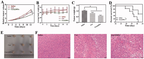 Figure 6. Anti-tumor efficacy of Cur@HFn in 4T1 breast cancer model. (A) Inhibition of tumor growth in vivo. (B) Weight change. (C) Weight of isolated tumor after drug treatment. (D) The survival rate of mice with or without treatment. (E) Photographs of tumors obtained after treatments. (F) H&E staining of tumor section at the end of anti-tumor study (scale bar: 50 μm).