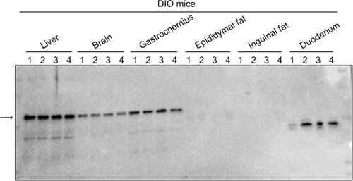 Figure 3 The MetAP2 tissue expression in DIO mice.