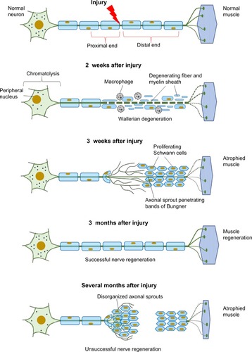 Figure 2 Cellular responses to nerve injury: nerve degeneration and regeneration.
