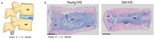Figure 3. The human intervertebral disc. A. Schematic view of the human lumbar spine, composed of vertebral bodies (VB) and intervertebral discs (IVD). B. Histological appearance of young and old human intervertebral discs stained with Alcian blue.