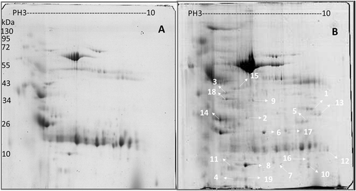 Fig. 1 Representative 2-DE gel image obtained from pooled protein samples.Comparison of (a) healthy individuals and (b) pulmonary tuberculosis patient proteins in pH 3–10 separated on 2-DE gels. Isoelectric points are indicated at the top and molecular weight markers in kDa on the left. The data are representative of two separate experiments. A p-value <0.05 indicates statistical significance using the two-tailed t-test