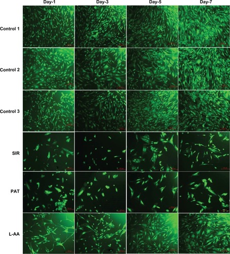 Figure 11 Fluorescence microscopy images of FDA stained SMCs for L-AA, SIR, PAT, and controls (scale bar indicates 100 μm).