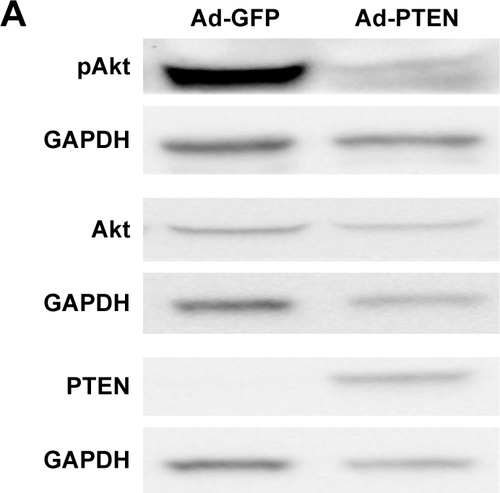 Figure S5 Adenovirus-mediated overexpression of PTEN and changes in cellular uptake of CNPs. (A) Representative Western blot analysis showing pAkt, Akt, and PTEN expressions in Ad-PTEN-infected lung fibroblasts. (B) Representative confocal microscopic images showing cellular uptake of CNPs (50 µg/mL) in the Ad-PTEN-infected IPF fibroblasts on collagen at 3 h post-incubation. (C) Comparative analysis of the cellular uptake of CNPs in Ad-GFP- and Ad-PTEN-infected IPF fibroblasts (n=4, **P<0.01). Scale bars = 25 µm.Abbreviations: CNPs, glycol chitosan nanoparticles; IPF, idiopathic pulmonary fibrosis; PTEN, phosphatase and tensin homolog; GFP, green fluorescent protein.