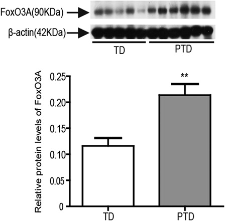 Figure 5. The protein expression of FoxO3A in placenta of PTD (n = 29) and TD (n = 29) by western blot. The relative protein density was normalized to β-actin. Bars indicate the mean value ± SD. Asterisks indicate statistical significance (0.001 < **P < 0.01). PTD, preterm delivery; TD, term delivery.