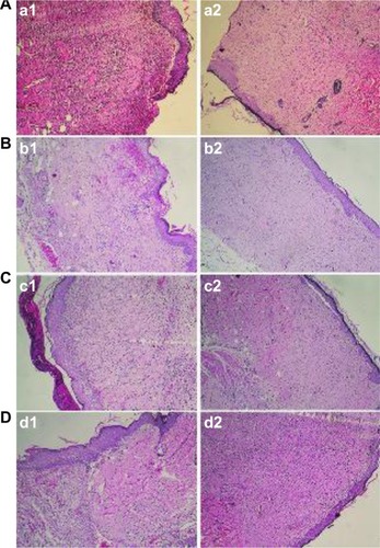 Figure 14 Histological examination after wounds had been covered for 7 and 14 days with (A) gauze, (B) the PVA/COS/AgNO3 nanofiber, (C) the PVA/COS-AgNP nanofiber, and (D) the commercial woundplast.Abbreviations: AgNP, silver nanoparticle; COS, chitosan oligosaccharide; PVA, poly(vinyl alcohol).