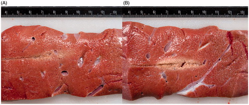 Figure 5. A comparison of gross pathology of treatment zones using (A) an internally cooled bipolar applicator and (B) an un-cooled applicator during the same IRE treatment protocol. Figure 3(B) clearly presents a centrally located white coagulated region as a result of thermal damage to the tissue, while Figure 3(A) shows much less thermally damaged tissue. Both images were taken prior the use of any staining.