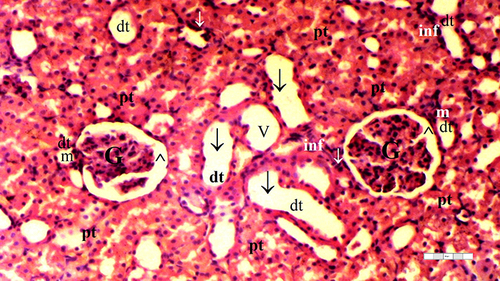 Figure 8 Representative light microscopy of kidney tissue from the dexmedetomidine ischemia-reperfusion group.