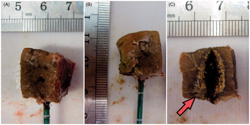 Figure 3. Example of a heat-treated cube: the 20-mm ex vivo bovine liver cube was ablated with a 14-gauge MW antenna operated at 60 W for 5 min. (A) and (B) Treated pieces of tissue with the antenna inserted. (C) Section of the cube along the antenna axis: the carbonised area is shown (red arrow).