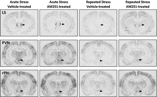 Figure 7. Representative autoradiographs of c-fos mRNA for neural regions with disruption of habituated response by low dose CB1 receptor antagonism. These images demonstrate the autoradiographic pattern observed in the neural regions in which a low dose of CB1 receptor antagonist AM251 (0.5 mg/kg, intraperitoneal injection) was not measured to potentiate expression of the immediate early gene resulting from a single acute loud noise stress exposure, but did significantly disrupt the expression of habituation of this marker of neural activity compared to vehicle-treated controls. LS: Lateral septum, PVN: Paraventricular nucleus of the hypothalamus, rPH: Rostral posterior hypothalamus (regions generally indicated with arrows).