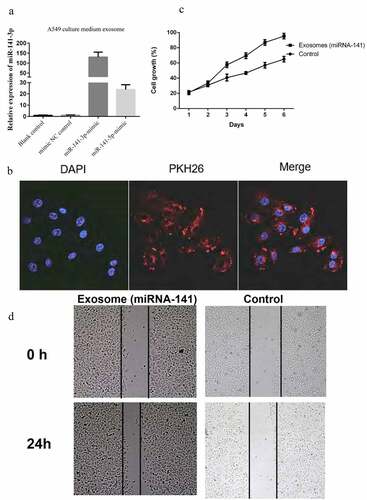 Figure 2. Exosome miRNA-141 promote lung cancer cells the proliferation and metastasis