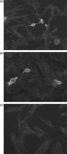 Figure 1.  Detection of GoCV-specific antibody using indirect immunofluorescence. BHK cells grown on coverslips and infected with replication-defective particles of the recombinant SFV/GoCVCap (1a and 1b) or with replication-defective particles of the recombinant SFV/LacZ vector (1c) were incubated with 1:50 dilutions of goose sera. Reactive goose antibodies were detected using an FITC anti-duck immunoglobulin conjugate. Sera containing GoCV-specific antibodies produced cytoplasmic fluorescent staining in cells with the recombinant GoCV antigen but not in cells with the recombinant LacZ antigen.