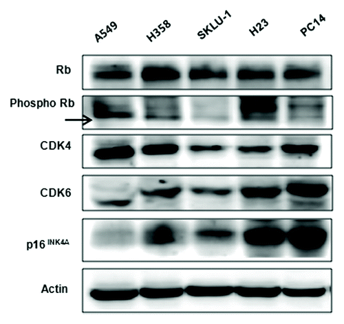 Figure 1. Baseline expression of p16/CDK4/Rb signaling molecules in 5 cancer cell lines. Constitutive basal expression of Rb, p-Rb, CDK4, CDK6, and p16INK4A were detected by western blotting. Actin was used as a loading control.