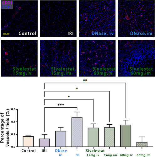 Figure 10 Immunofluorescence staining of CD31 in the ischemic area 14 d after ischemia-reperfusion injury of rat hindlimb muscles. Angiogenesis in the IRI region was assessed by labeling vascular endothelial cells with anti-CD31 antibody (red fluorescence). Single or clustered CD31-positive signals were counted as vascular vessels. Both DNase I and sivelestat treatment contributed to angiogenesis, with local injection of DNase I have the most obvious effect. Cell nuclei were stained with DAPI (blue fluorescence). Scale bar = 100 μm. n=3, data are expressed as mean ± standard deviation, *P < 0.05, **P < 0.01, ***P < 0.001.