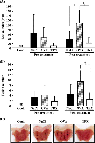 Fig. 3. The effects of yeast TRX on WRS-induced gastric ulcers.Notes: Lesion indexes (A) and the number of gastric ulcer lesions (B) in rats pre-treatment or post-treatment with the administration of recombinant yeast TRX in a 0.85% NaCl solution, OVA in a 0.85% NaCl solution, or a 0.85% NaCl solution alone. The animals employed as a negative control group were administered with a 0.85% NaCl solution alone and not exposed to WRS. The values are given as mean ± SD (n = 5). The *symbols indicate values significantly different at p < 0.05. The **symbol indicates values significantly different at p < 0.01. ND: not detected. (C) Pictures of excised stomachs from rats in the post-treatment groups.