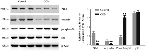 Figure 3. Down-regulation of tight junction related proteins in MDCK cells by COM crystals treatment. Protein levels were detected by Western blot after MDCK cells were treated with or without 1 mM COM crystals for 48 h. The quantifications of data were represented as mean ± SD on the right panel. **p < .01 versus control.