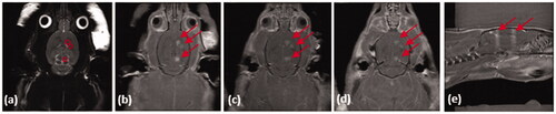 Figure 7. MRIgFUS with AAV2-Sirt3 conjugated MBs causes temporary opening of the BBB in striatum and substantia nigra. (a) The striatum (2 treatment points) and the substantia nigra (1 treatment point) were targeted unilaterally from T2-weighted images (targets are outlined by red circles). Following FUS treatment (US parameters described in material and methods section), the contrast agent gadolinium was given intravenously and (b–d) T1W transverse and (e) saggital images were taken in which the red arrows demonstrate BBB opening. It should be noted that only the sonicated hemishphere demonstrates BBB opening.