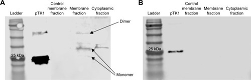 Figure 8 Western blot of membrane and cytosolic fractions in Raji cells and normal lymphocytes and probed with anti-TK1 antibody.