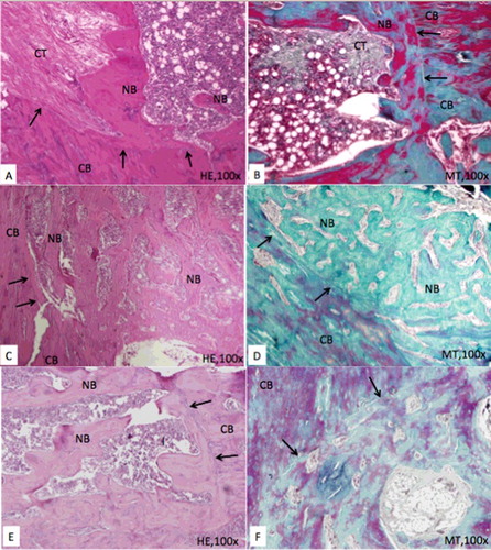 Figure 2. Representative photomicrographs of the defect area in each group (A and B: control group, C and D: test 1 group, E and F: test 2 group). Defect area consists of a fibrous callus and new bone trabeculae in all groups. Note: The high amount of new bone trabeculae and the active osteoblasts lining of these trabeculae in TQ groups when compared to control group. Arrows show the border of the defect. CB: compact bone, NB: new bone, CT: connective tissue, HE: haematoxylin & eosin, MT: Masson's trichrome.