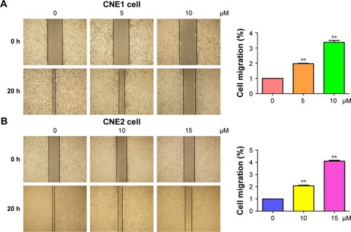 Figure 3 Curcumin inhibited cell migration in NPC cells.