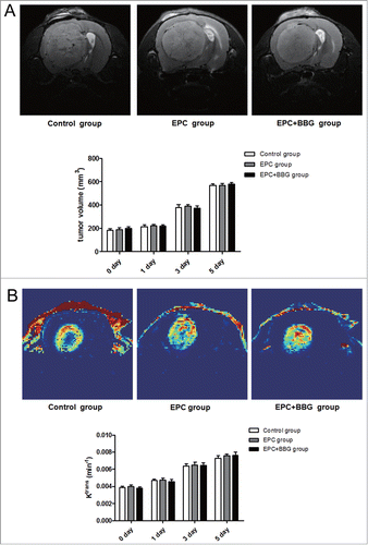 Figure 7. Effects of P2X7 receptors inhibition on rats in situ glioma growth and neovascularization. (A) Representative axial T2-weighted imaging (T2WI) images of rats with glioma at 5 d post-transplantation of EPCs obtained from different groups (Control group, EPC group, EPC + BBG group). Glioma was region with high intensity on T2WI images (top). Moreover, to evaluate the effect of BBG on tumor growth, tumor volume of different groups was determined using Advantage Workstation (bottom). (B) Representative Ktrans maps of rats with glioma at 5 d post-transplantation of EPCs obtained from different groups. Red and blue represent relative higher- and lower-value, respectively (top). Changes of Ktrans value in these 3 groups were analyzed (bottom). Data are mean ± SD from 6 independent experiments.