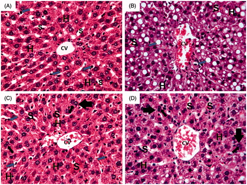Figure 5. Photomicrographs of liver section obtained from different groups (H&E; 400×), where  (A) normal control group showing normal hepatic architecture with central vein (CV) and radiating cords of normal hepatocytes (H) with central rounded vesicular nuclei and prominent nucleoli. Hepatic cords are separated by blood sinusoids (S) lined with endothelium and von Kupffer cells (blue arrow); (B) ferrous sulphate group showing dilated congested central vein (CV) with congested blood sinusoids (S). Massive fatty infiltration of hepatocytes (H) with some hepatocytes acquired the signet ring appearance (blue arrow); (C) N-acetylcysteine plus ferrous sulphate group showing congested central vein (CV). Normal hepatocytes (H) are separated by slightly dilated congested blood sinusoids (S) with activated von Kupffer cells (blue arrow). Binucleated cells (black arrow) can be seen; (D) saponin plus ferrous sulphate group showing congested central vein (CV). Normal hepatocytes (H) are separated by slightly dilated congested blood sinusoids (S) with activated von Kupffer cells (blue arrow). Binucleated cells (black arrow) can be seen.