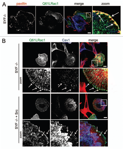 Figure 2 Src cooperates with activated Rac1 in the recruitment of Cav1 to FAs. (A) SYF (-/-) MEFs were grown on glass cover slips and transfected with myc-tagged Rac1 (Q61L). After 24 h, cells were fixed and stained for (co)localization of Rac1Q61L and endogenous paxillin as indicated by the arrows (scale bar, 20 µm). (B) The (co)localization of myc-tagged Rac1 (Q61L) with endogenous Cav1 was analyzed by immunostainings in SYF(-/-) MEFs and Src knock-in SYF (-/-) MEFs (SYF-/- + Src MEFs). In the SYF-/- cells, there is noo co-localization detectable between peripheral Rac1 and Cav1. In contrast, in the Src reconstituted cells, colocalization between Rac1 and Cav1 at the periphery of the cells is detectable and these are indicated by the arrows. (Scale bar, 20 µm).