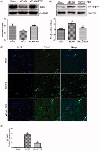 Figure 6. Effects of PTH on the NF-κB p65 pathway in MCAO rats (n = 3). (A) Representative western blot and quantitative analysis of IkBα in different groups. (B) Representative western blot and quantitative analysis of NF-κB p65 in different groups. (C) Representative immunofluorescent staining sections in different groups. (D) Quantitative analysis of the nucleus/cytoplasm ratio of NF-κB p65 in different groups. The cytosolic/nuclear translocation of NF-κB p65 was examined using immunofluorescent staining (magnification, ×200). NF-κB p65 of the normal neurons was expressed in the cytoplasm (white arrow). NF-κB p65 of the abnormal neurons was highly expressed in the nucleus (red arrow). Data are presented as mean ± SEM. *p < 0.05, **p < 0.01 vs. Sham; #p < 0.05, ##p < 0.01 vs. MCAO. Scale bar = 50 μm.