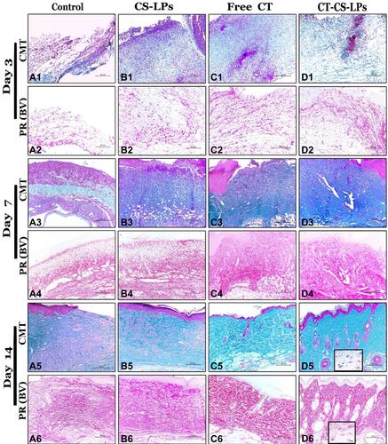 Figure 9 Photomicrographs of skin sections from all studied groups on the 3rd, 7th, and 14th days post wound creation, showing the total collagen fibers appeared green by Crossman’s trichrome stain and red by Picrosirius red stain (bright-field view); control (A1–A6), CS-LPs (B1–B6), Free CT (C1–C6) and CT-CS-LPs (D1–D6) groups.