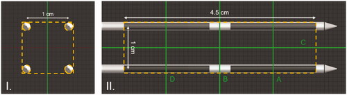 Figure 3. Graphical representation of the planes perpendicular (I) and parallel (II) to the applicators. The volume of interest (VOI) is illustrated as a yellow dashed line. The green lines illustrate the cross-sectional planes A, B, C, and D, which are used for temperature maps in Figure 5 and Figures 8–10.