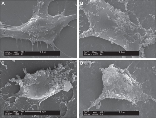 Figure 10 SEM observation of nano-COD crystal adhesion to H2O2-treated Vero cell surface.Notes: Vero cells were treated with (A) 0 mmol/L (B) 0.3mmol/L (C) 0.5 mmol/L, or (D) 1.0 mmol/L H2O2 for 1 hour and then incubated with 100 μg/mL nano-COD for 6 hours. Scale bars: 5 μm.Abbreviations: COD, calcium oxalate dihydrate; SEM, scanning electron microscopy.