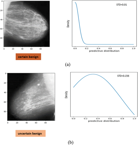 Figure 6. Examples of breast cancer images and corresponding approximate predictive probability distribution produced by the bayesian inference. (a) image with low uncertainty in prediction from DDSM as certain benign and (b) image with high uncertainty in prediction from DDSM as benign. This case is predicted benign but slightly uncertain. The corresponding standard deviation (STD) as uncertainty is shown.