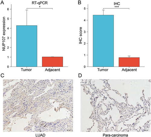 Figure 10 (A) The expression levels of NUP107 were compared in the tumor versus the adjacent lung tissues by RT-qPCR. (B) Comparison of IHC scores between LUAD tissue and adjacent lung tissue. (C and D) Immunohistochemical images of tumor tissue and adjacent lung tissue from a LUAD patient. *p < 0.05; ***p < 0.001.