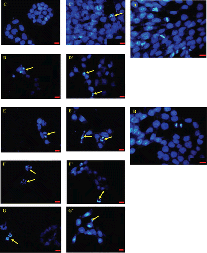 Figure 3.  Chromatin condensation and observation of apoptotic bodies on V79 379A cell cultures evaluated after 12 h, stained with DAPI. (A) Control. (B) Cells treated with DMSO. (C-D-E-F-G) Cells treated with Pt(phen)Cl2 2,5-5-10-20-40-80 µM, respectively. (C’-D’-E’-F’-G’-) Cells treated with [Au(phen)Cl2]Cl 2,5-5-10-20-40-80 µM, respectively. Arrows show classical apoptotic bodies. Scale bars 20 µm.