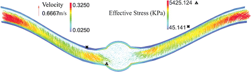Figure 5. Velocity vector and effective stress for the aneurysmal carotid artery under pulsatile flow with a lumen pressure of 130 mmHg and a stretch ratio of 1.3 at the time of maximum deflection.