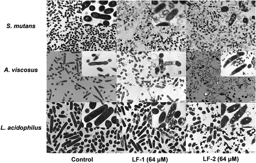 Figure 3. TEM observations of bacterial membrane and intracellular structure of S. mutans, A. viscosus, and L. acidophilus after treatment with 64 μM LF-1 and LF-2