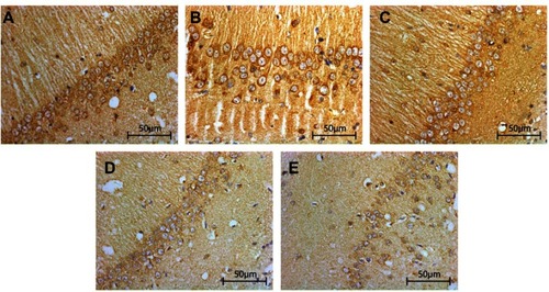 Figure 6 Changes in the hippocampal expression of BDNF in rats of each group. Immunohistochemical staining of BDNF in the hippocampi of TBI rats after TCST (×400). A–E: (A–C) The visual fields at time T0 in Sham group, TBI group and TBI+TCST group under an optical microscope. The expression of BNDF was increased at T0 in the three groups. (D) The visual fields at all time points except for T7 in TBI+TCST group under an optical microscope. The expression of BNDF was increased in TBI+TCST group compared to that in the other two groups. (E) The visual fields at all time points in TBI group under an optical microscope. The expression of BNDF was increased more significantly in TBI group than in the other two groups. Six rats per group.