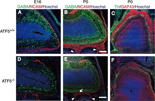 Fig. 3. Sparse interneurons and impaired surrounding of the OB by ONL in ATF5–/– mice.